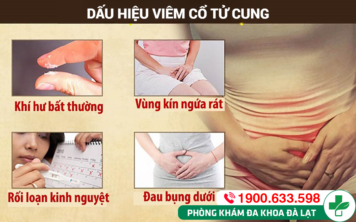 Hình ảnh minh họa